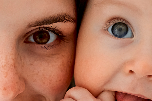 Retinoblastoma: o que você precisa saber sobre o câncer ocular que afeta crianças